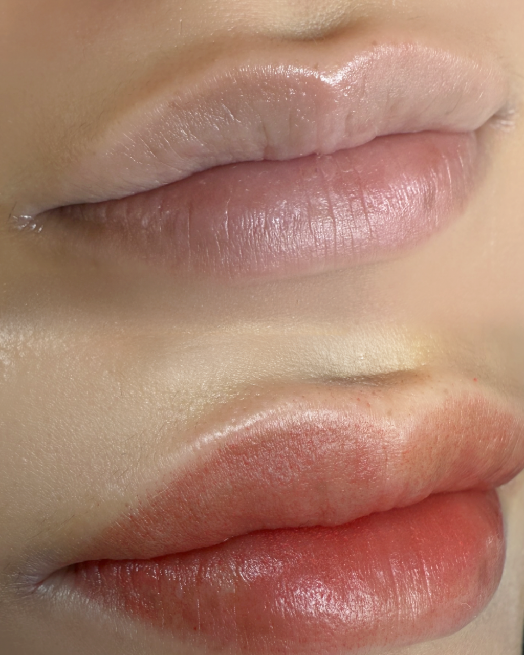 柏ローマピンク♡世界で話題のローマピンク導入しました！！